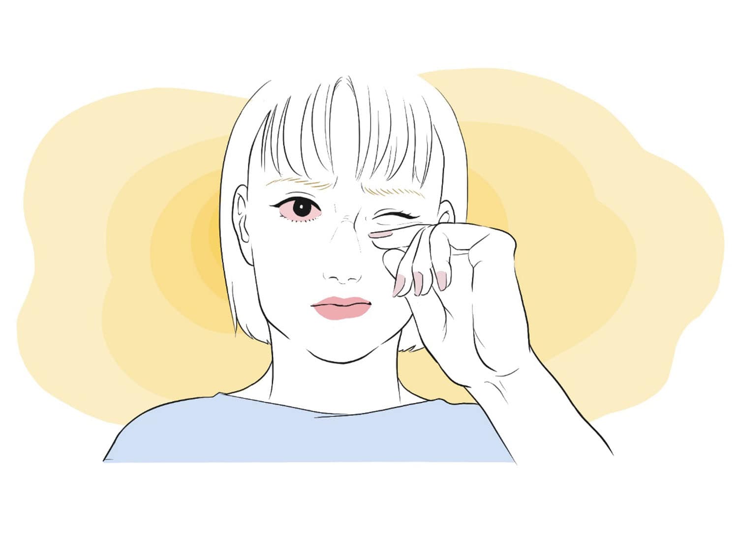 コンタクトレンズで目が充血したらどうする?原因や対処法を紹介