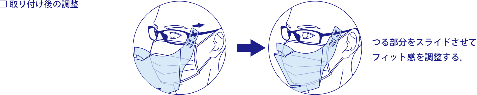 3dcshieldの組み立て方法画像（取り付け後の調整）