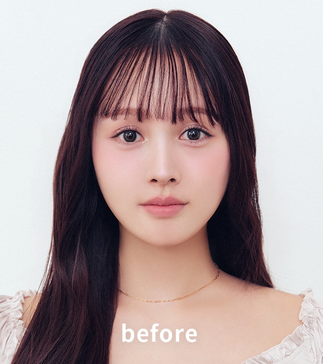 中顔面短縮みえ before